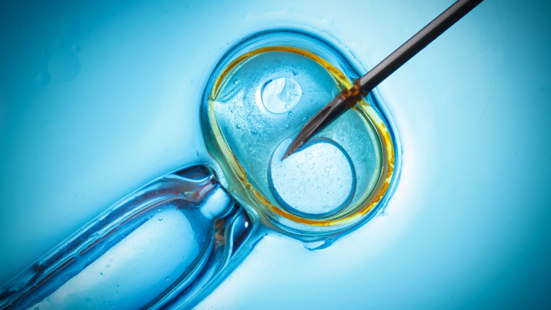 IVF Treatment